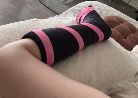 brokenankle93 leaked gallery photo 2